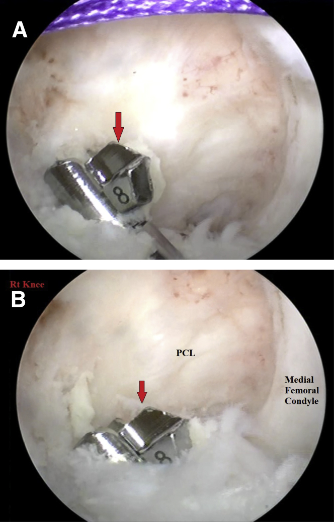 Fig 8