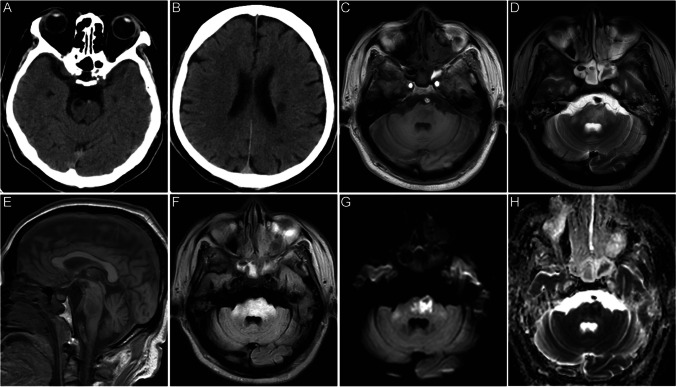 Fig. 1