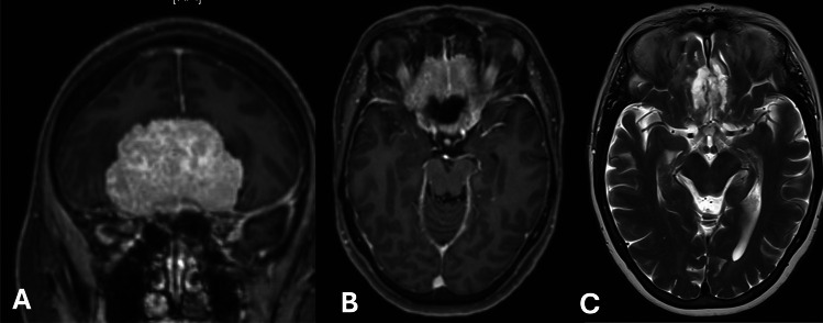 Fig. 1