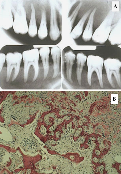 Fig. 11