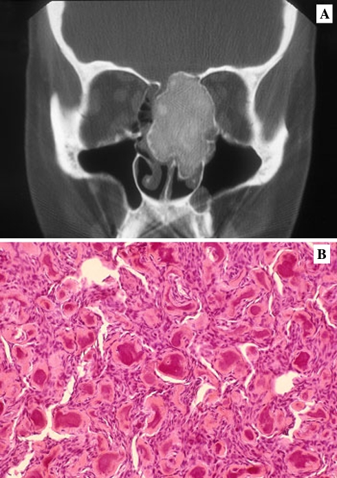 Fig. 16