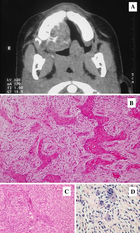 Fig. 15