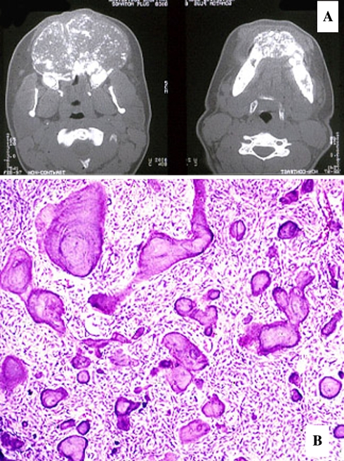 Fig. 17