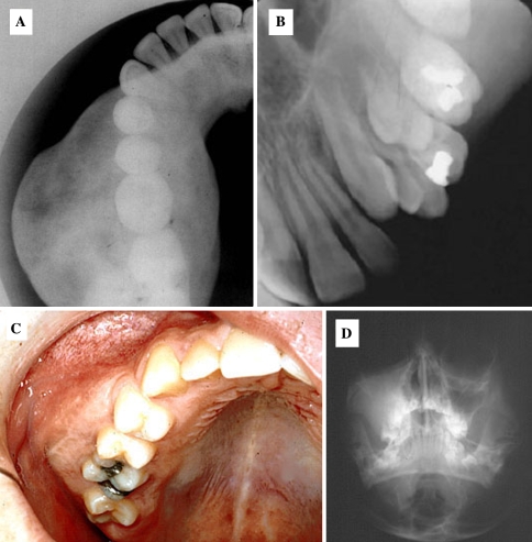 Fig. 2