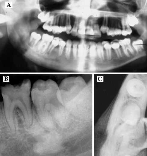 Fig. 9