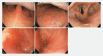Fig. 1
