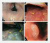 Fig. 4 a