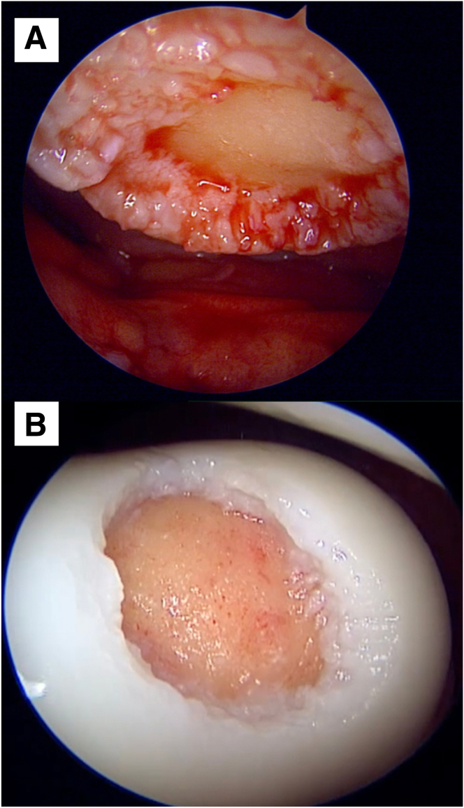 Fig 5