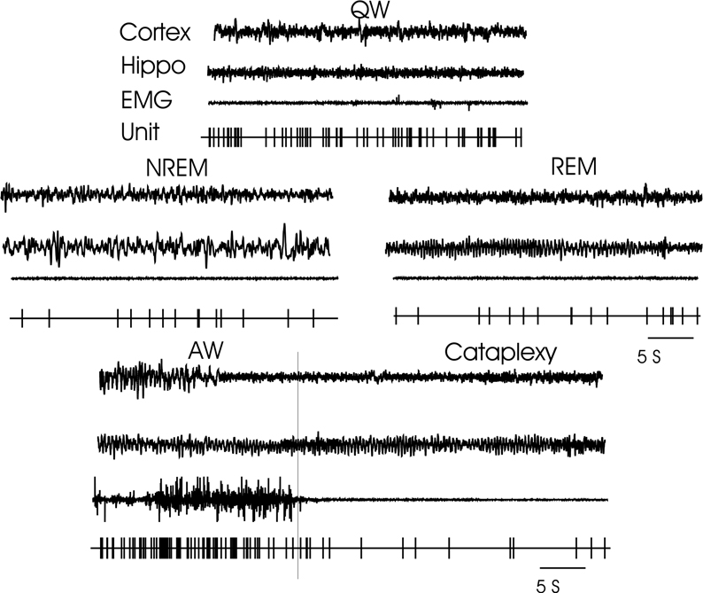 Fig. 11.