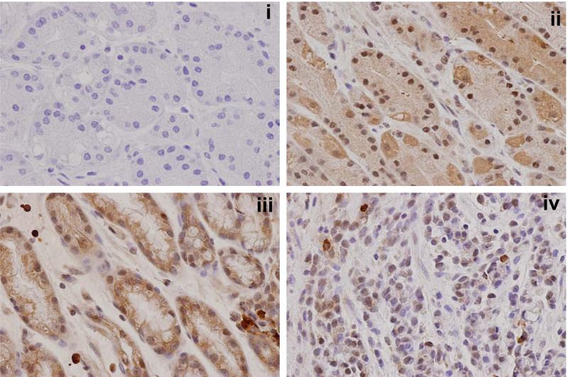 Figure 1B