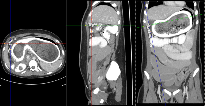 Fig. 2