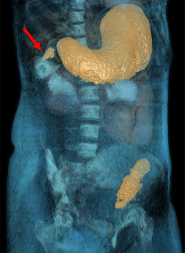 Fig. 3