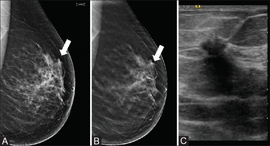 Figure 3 (A-C)