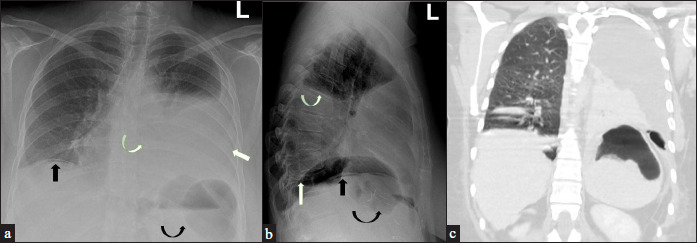 Figure 10: