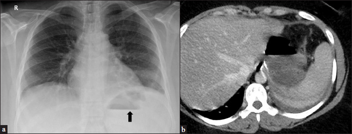 Figure 5: