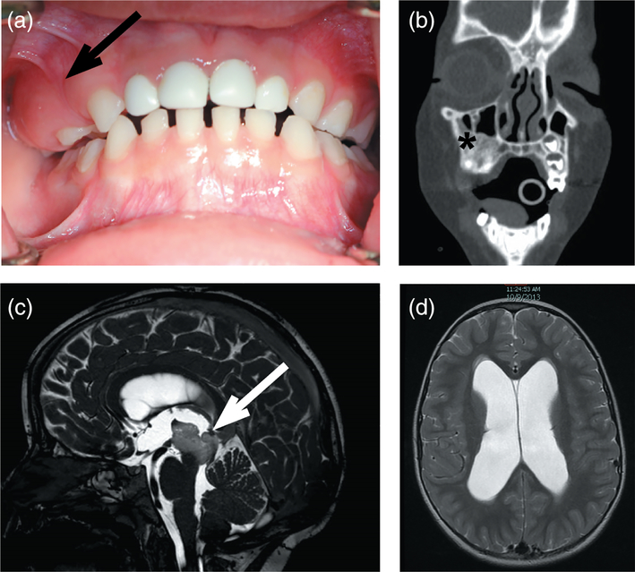 FIGURE 1