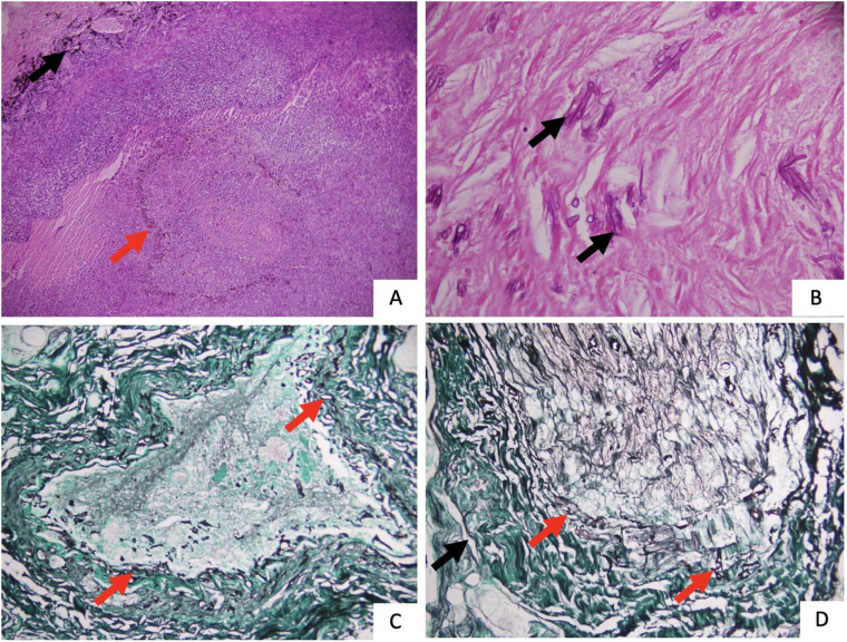 Fig. 3