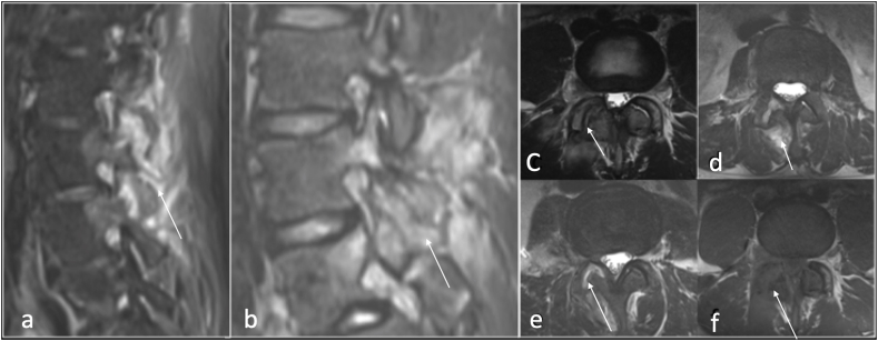 Fig. 10