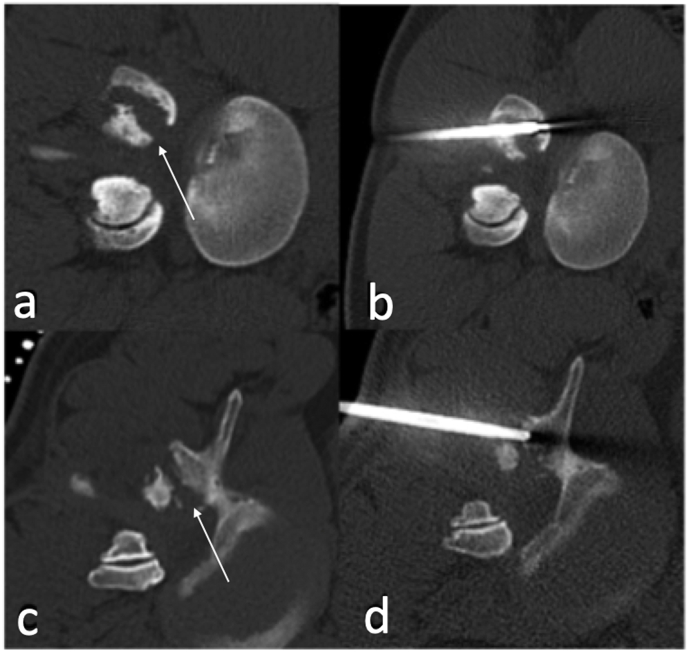 Fig. 11