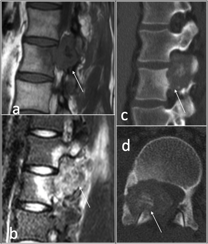 Fig. 13