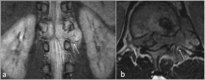 Fig. 18