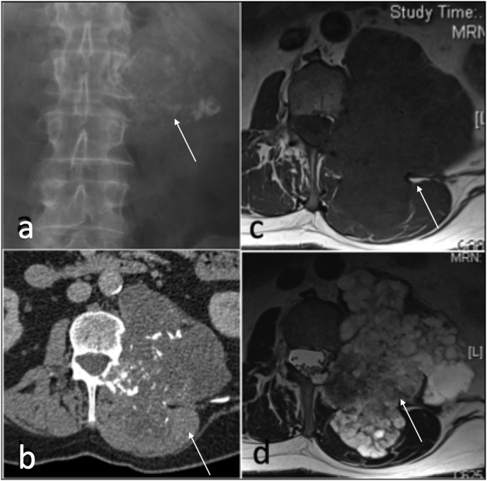 Fig. 17