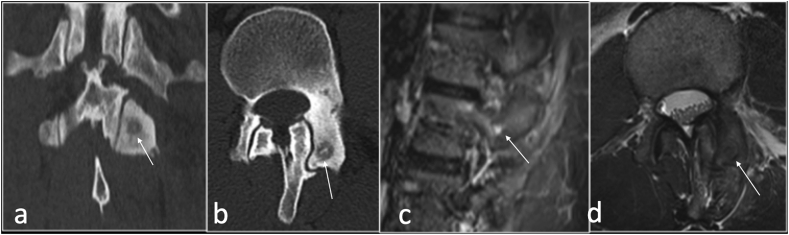 Fig. 12