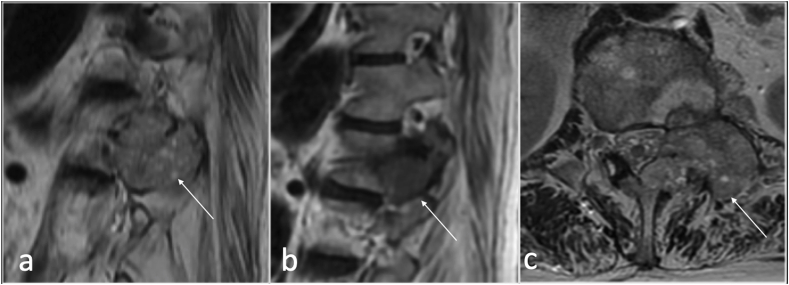 Fig. 16