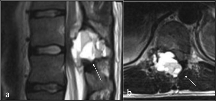 Fig. 14