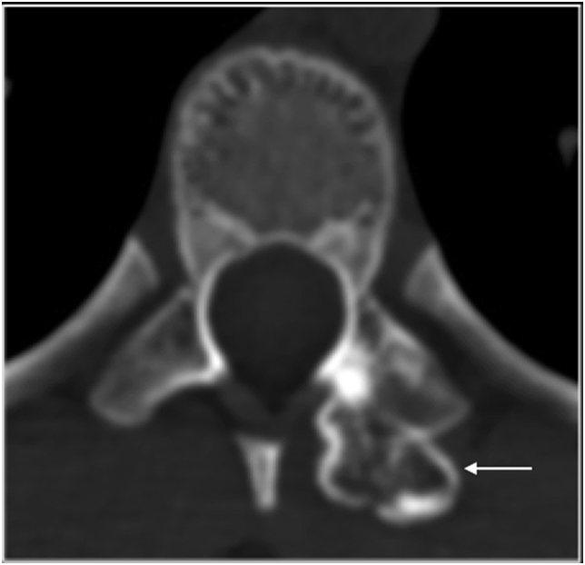 Fig. 15