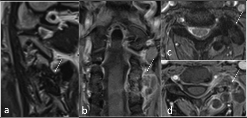 Fig. 8