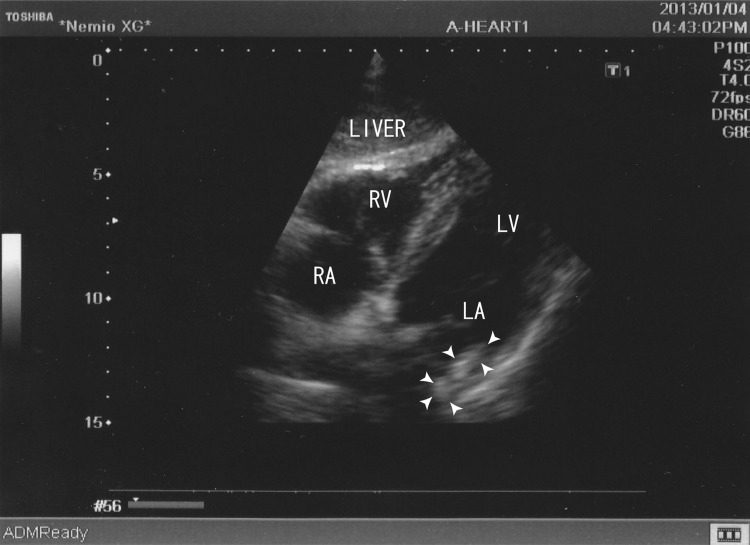 Figure 3