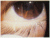 Fig 1.—