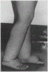 Fig 2.—