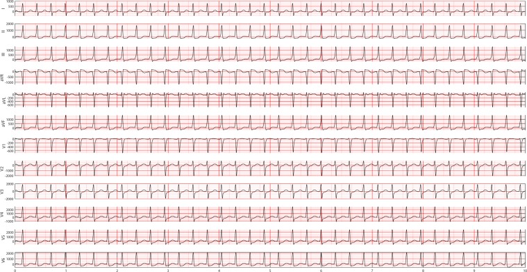 Figure 12