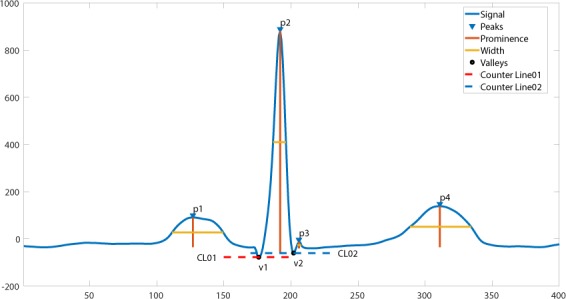 Figure 14