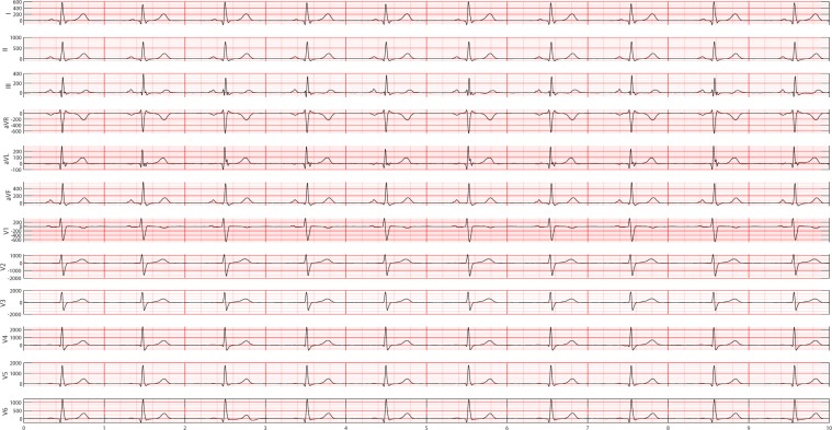 Figure 13