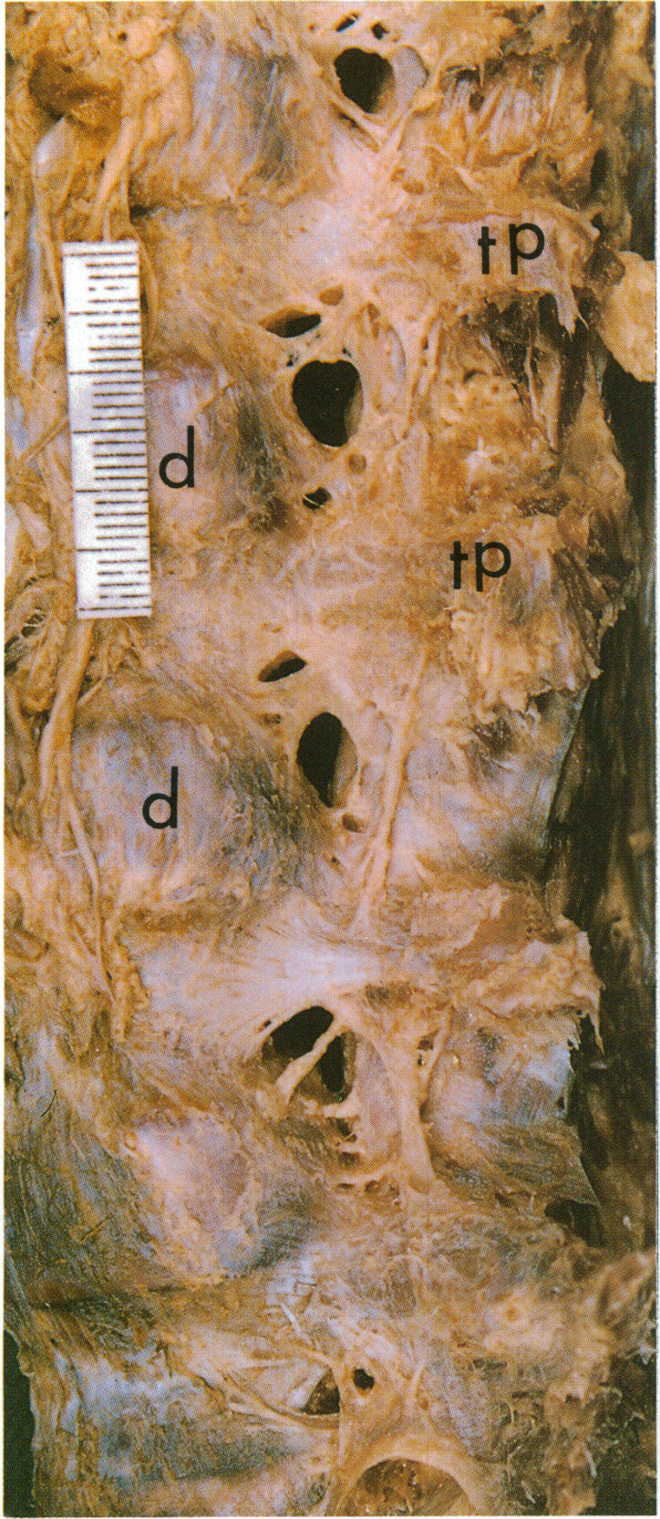 Fig. 2(i)