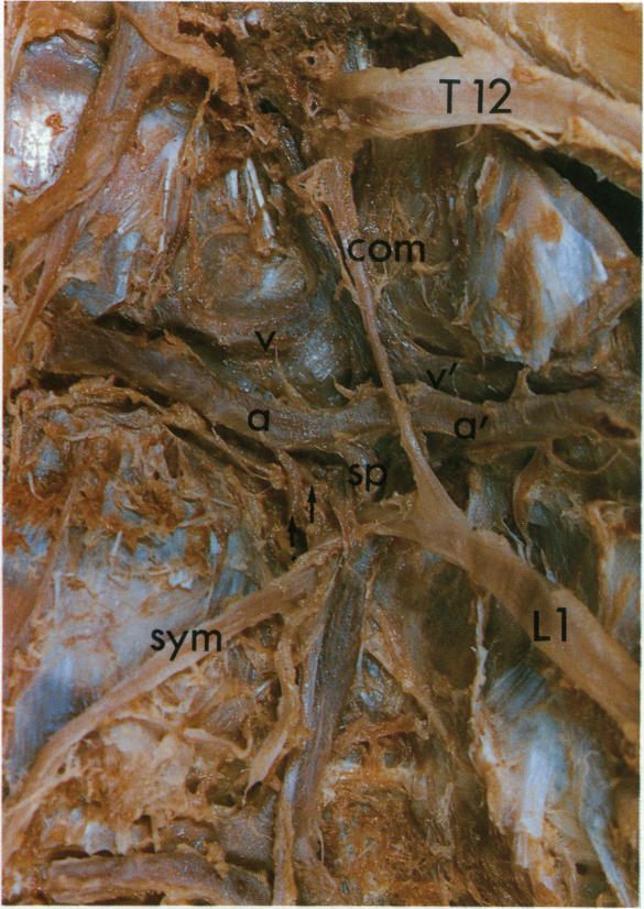 Fig. 1(i)