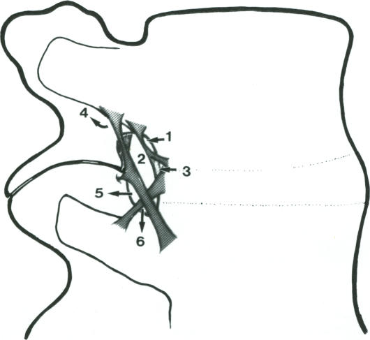 Fig. 6(ii)