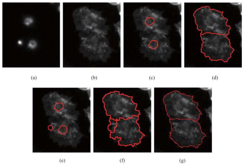 Fig. 11