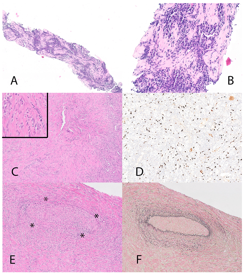 Figure 1: