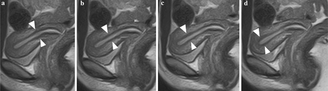 Figure Fig. 4