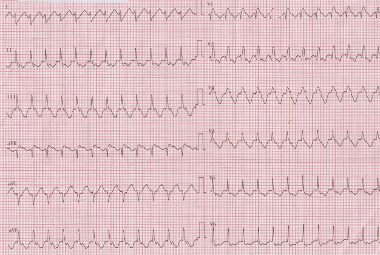 Figure 1: