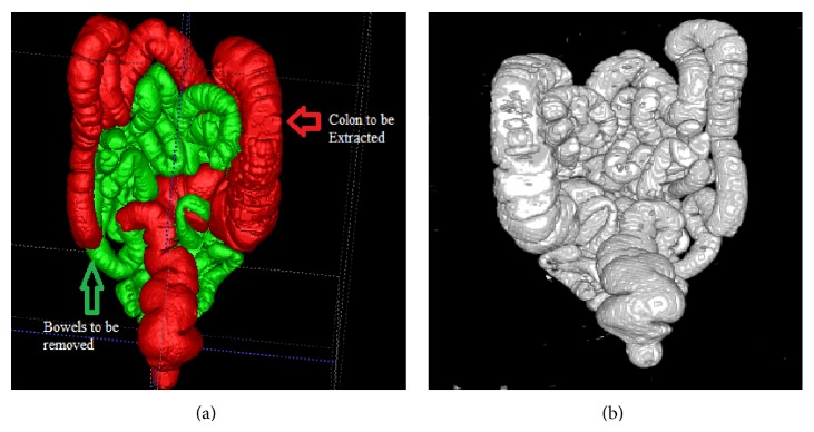 Figure 11