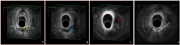 Fig. 2