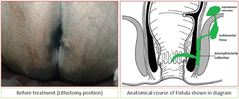 Fig. 1