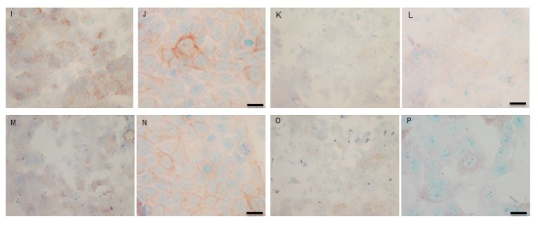 Fig. (9 I-P)