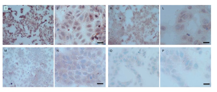 Fig. (10 I-P)