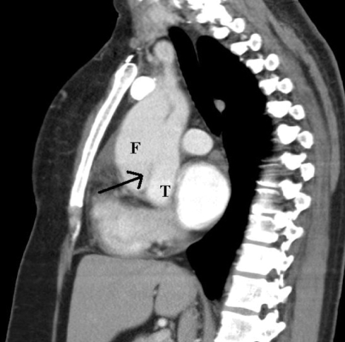 Figure 4)